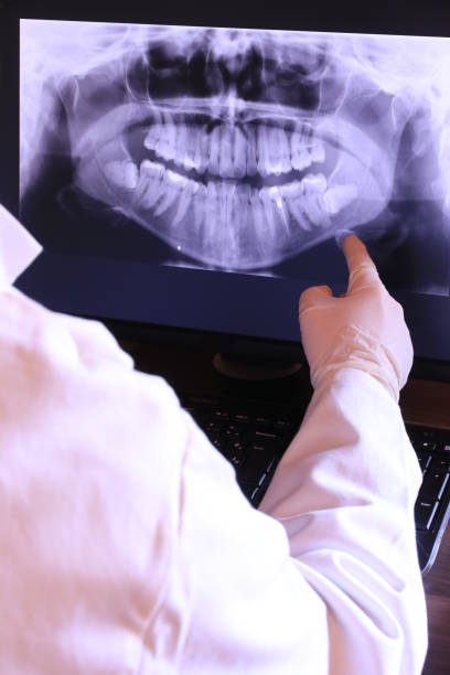 Best Emergency Dental Care for Abscessed Tooth in Belfair, WA